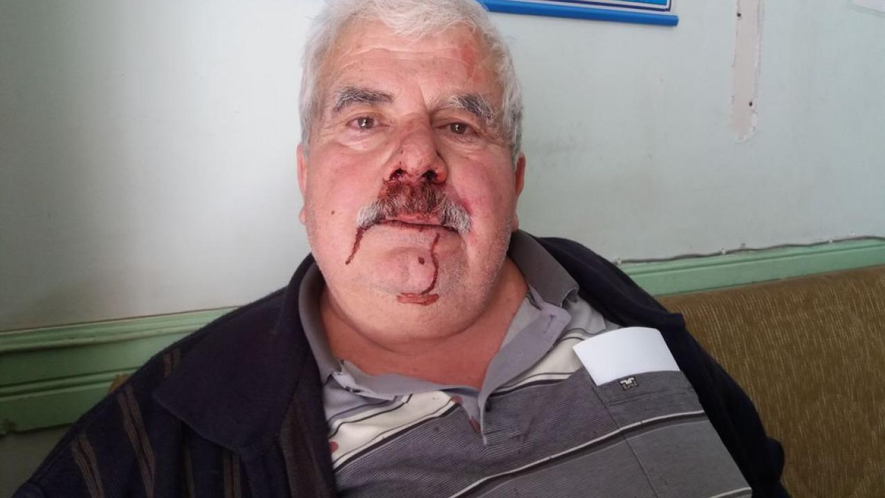 Τα καρπούζια της οργής: Ζήτησε χρωστούμενα κι έφυγε χτυπημένος